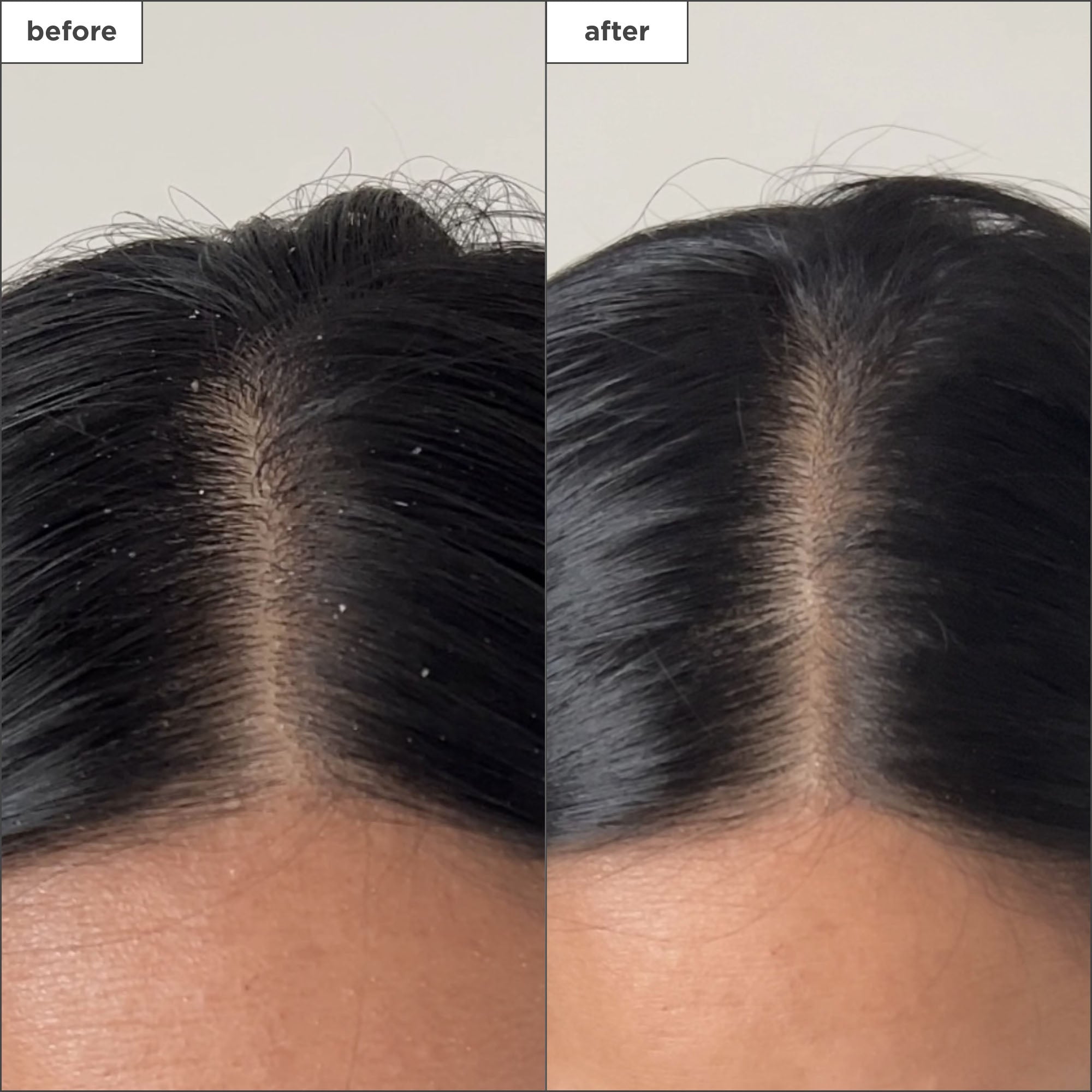 Scalp Revival Charcoal + Tea Tree Buildup Detox Spray - Briogeo